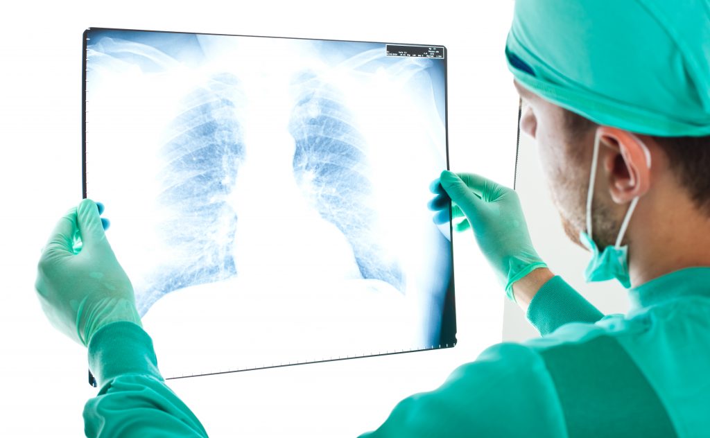 x-ray